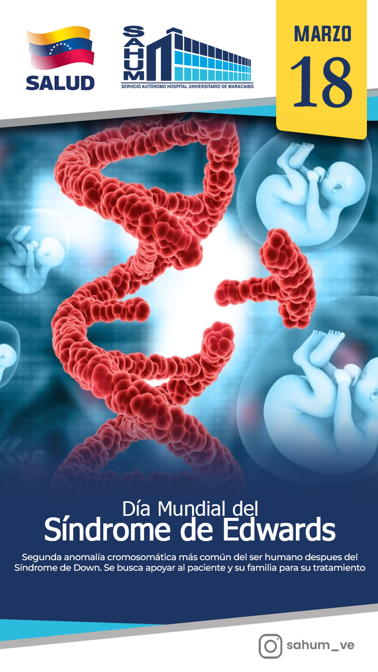 Día Mundial del Sindrome de Edwards