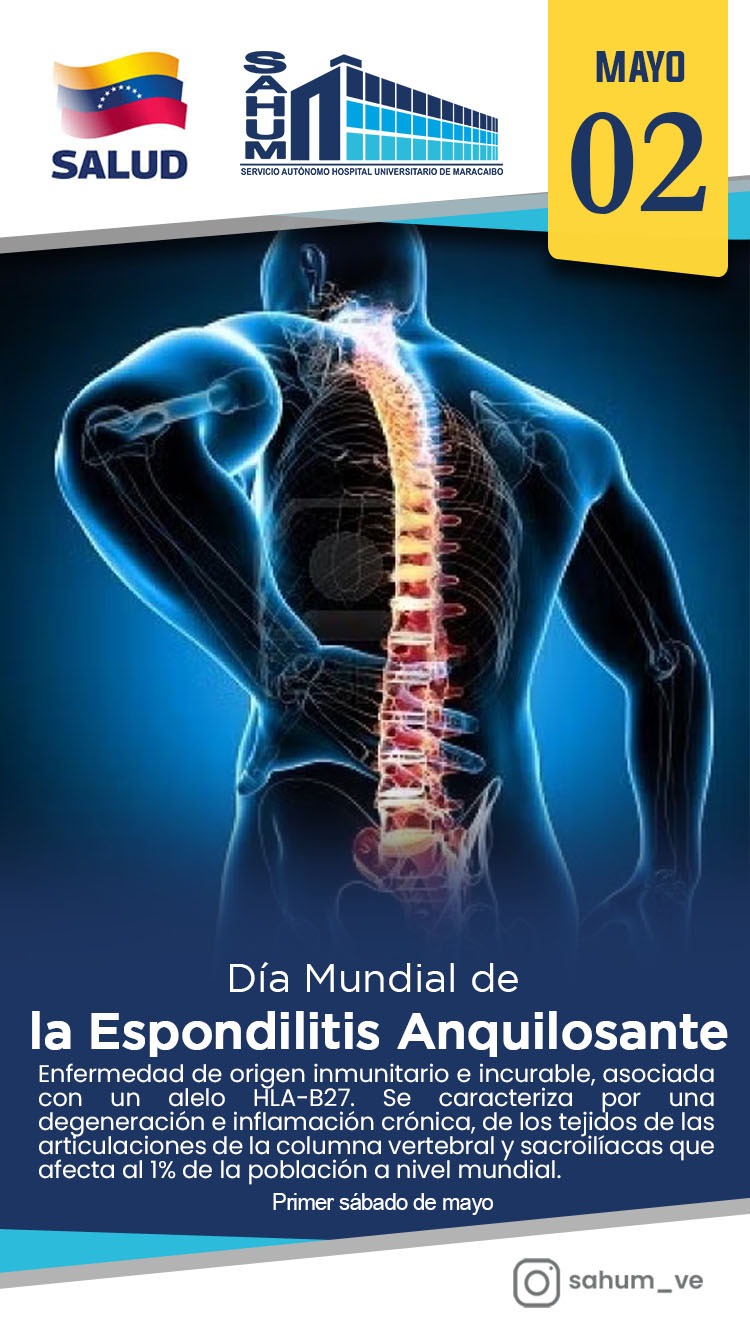 La Espondilitis Anquilosante