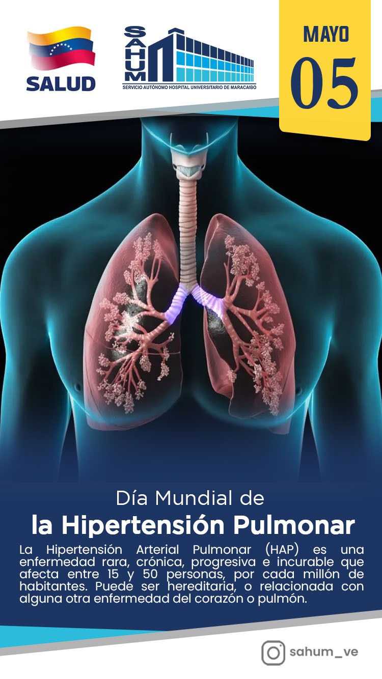 La Hipertension Pulmonar
