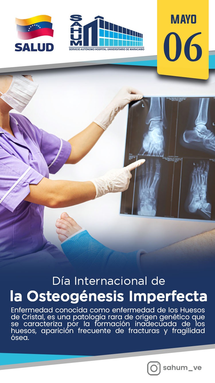 La Osteogenesis Imperfecta