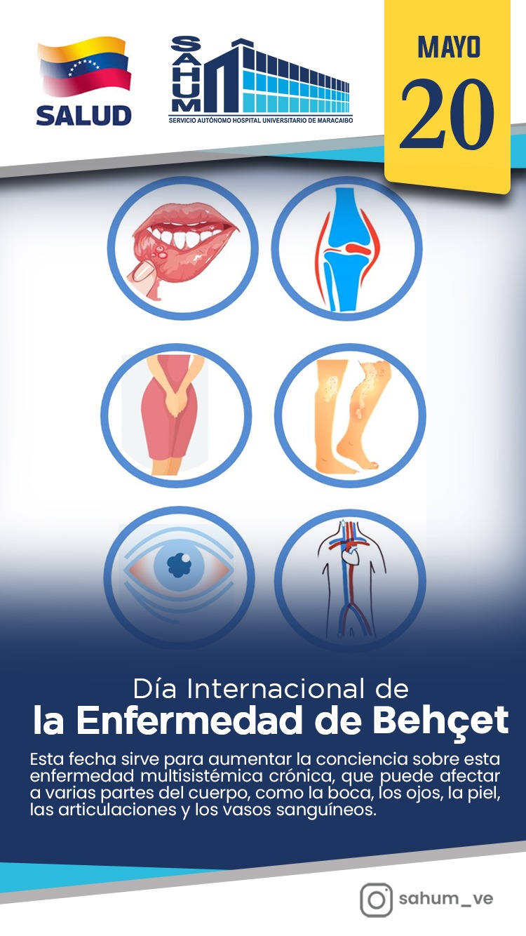 Enfermedad de Behcet