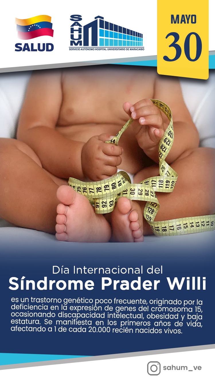 Sindrome Prader Willi