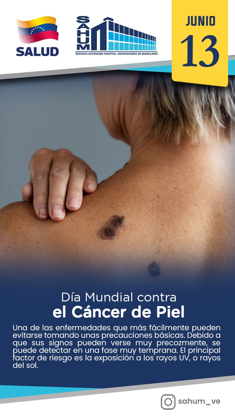 Derechos del Nacimiento