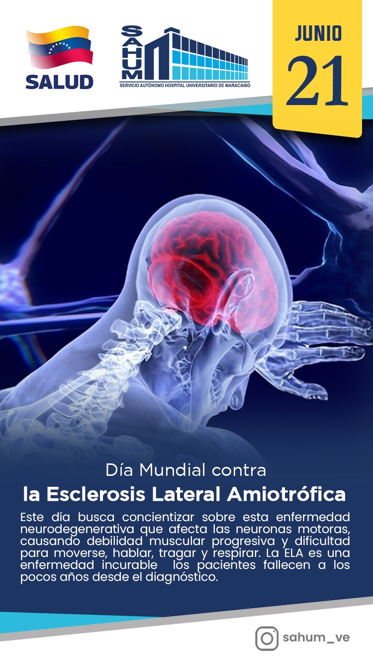 Esclerosis Lateral Amiotrofica