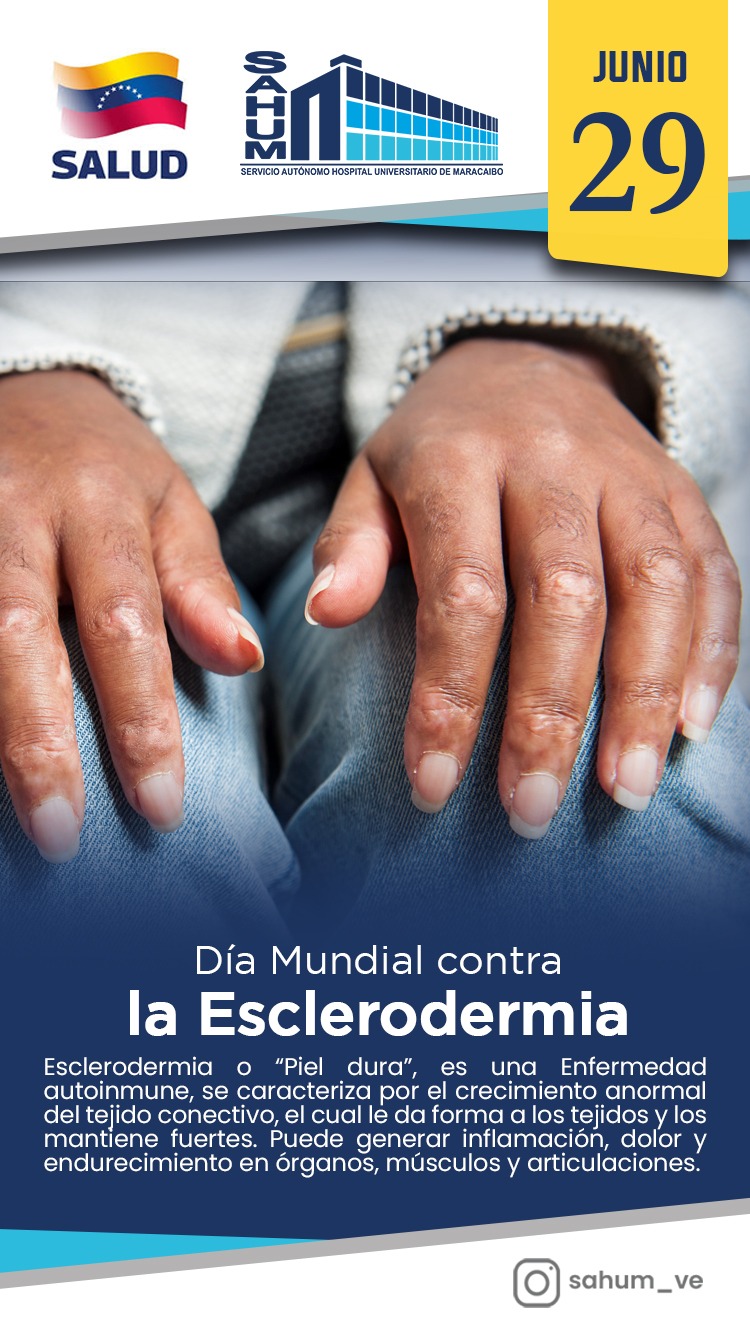 Esclerodermia